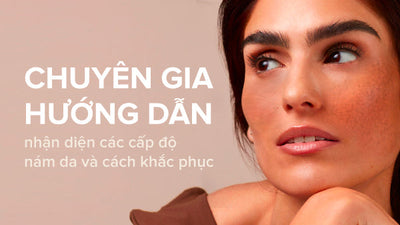 Chuyên gia hướng dẫn nhận diện các cấp độ nám da và cách khắc phục